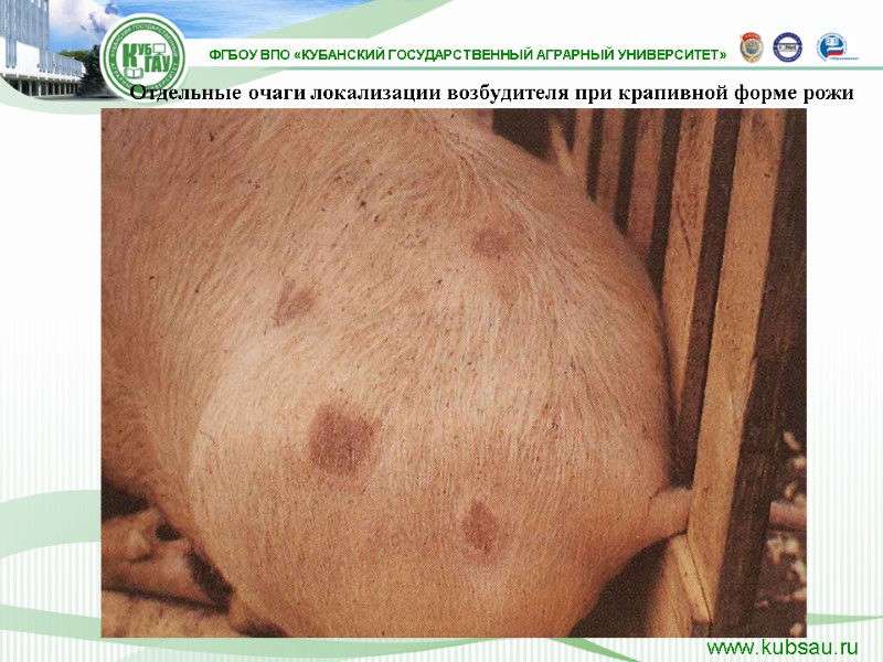 Отдельные очаги локализации возбудителя при крапивной форме рожи